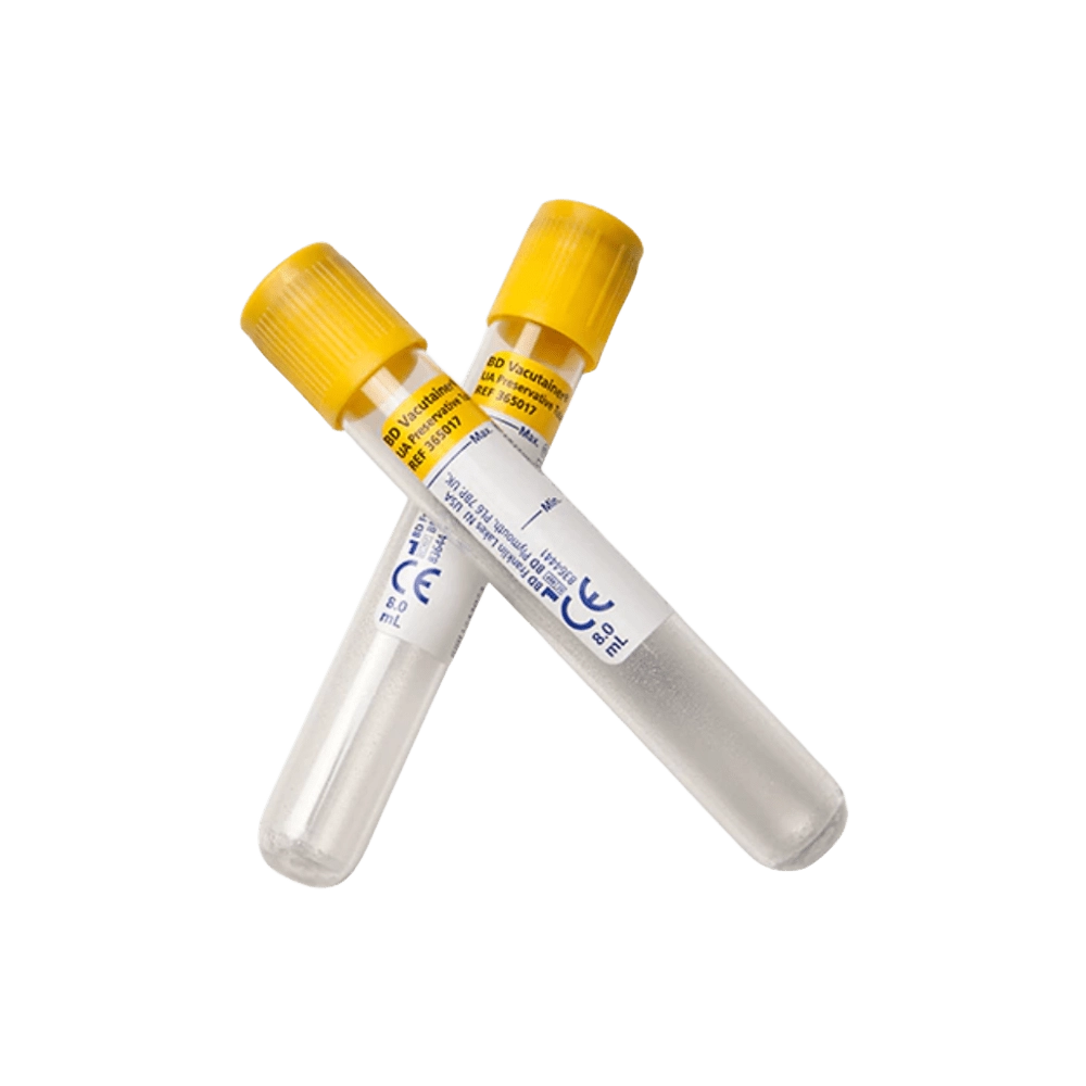 Tubo Vacutainer Orina. Tubo Vacutainer Orina.